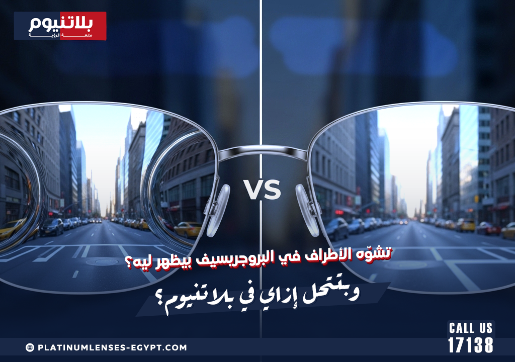 تشوّه الأطراف في البروجريسيف بيظهر ليه؟ وبتتحل إزاي في بلاتنيوم؟